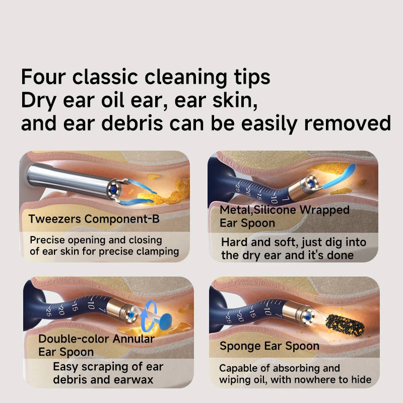 1 EarSight  Bebird  Plus I35R Visual Ear Cleaner