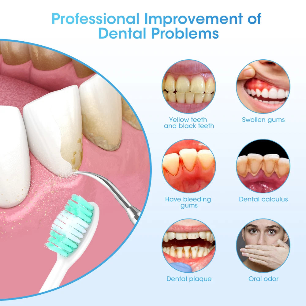 1 A Dental Calculus Removal