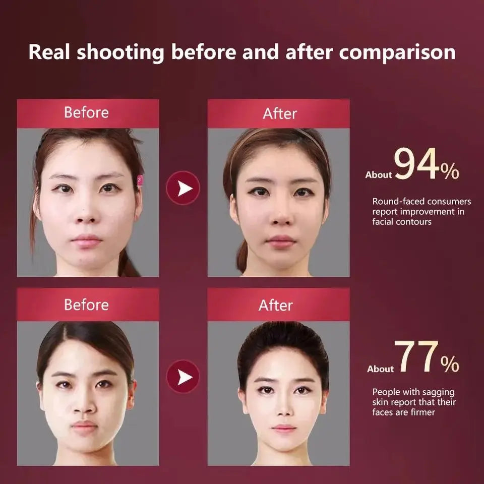 1 V-line Facial Lifting Massager