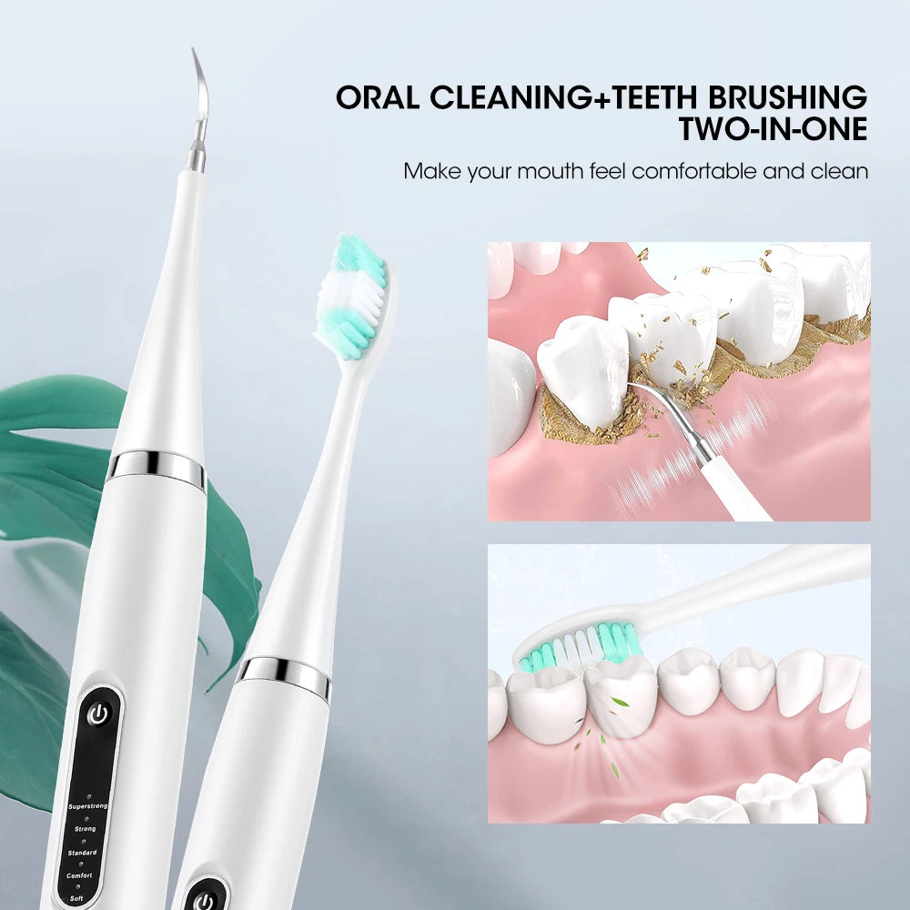 1 A Dental Calculus Removal